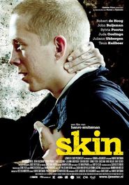 Skin is the best movie in Robert de Hoog filmography.