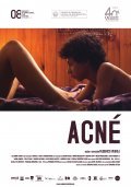 Acne movie in Federico Veiroj filmography.